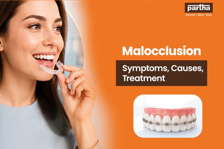 malocclusion