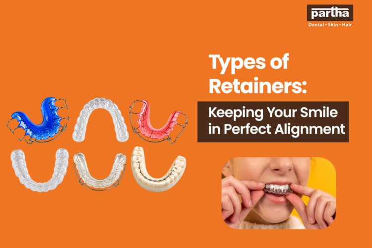 types of retainers