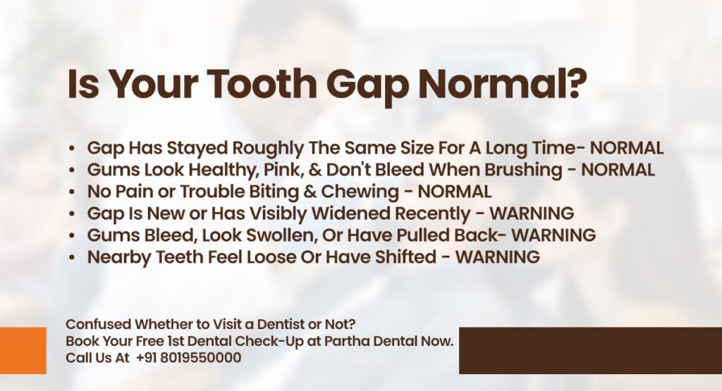 Diastema Causes and Treatment: Is Your Tooth Gap Normal? 3 is your tooth gap normal